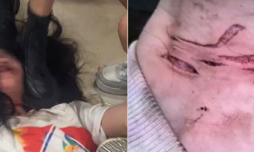 15岁女生遭同学多次霸凌，为逃避殴打捡玻璃片“割喉求生”