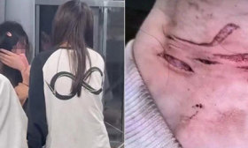 14岁女生遭同学反复殴打后割腕：“被她们打死，还不如自己去死”