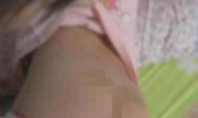 小学生因背书背不出 遭老师钢管体罚狠打50次