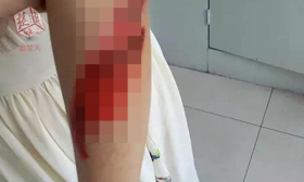女博士被人猛推下几十级台阶 涉事者称想听尖叫