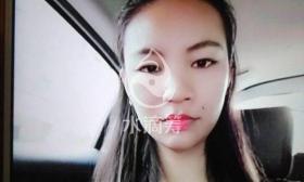  处理父亲后事途中遇车祸 川大女生双腿粉碎性骨折