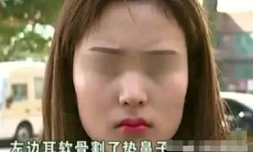 18岁女孩辍学去整容，竟把耳朵割下垫鼻子，最后却变样了