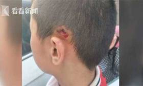 实习老师下狠手!小学生被扔向墙壁 校方竟这么说