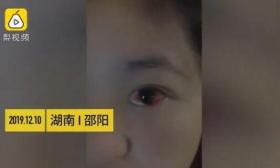 女生打伤同学 其父亲:先登门放鞭炮道歉我们再赔偿