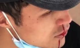 大学男生看到长腿女生后开始狂流鼻血，当事人：我可能是中暑