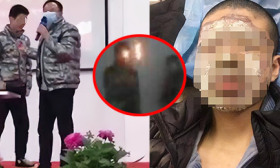 15岁男生家长会上表演吐火烧伤！班主任：出事与我无关