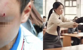 初中生与怀孕女老师互扇耳光，被老师丈夫持螺丝刀刺伤眼球？