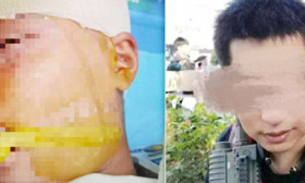 被打破头骨的9岁女生仍在ICU，同学哭喊“老师杀人了”