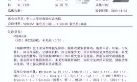 院士高中儿子连发SCI论文，“中山二院”事件背后，利益在环环相扣