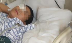 13岁男孩遭老师掌掴后右眼失明 家属：曾嘱咐老师别打头部