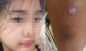 “素质学校”教官体罚14岁女生致其昏迷？父亲：脱光在地上爬