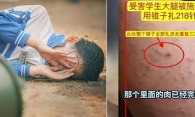“女生被同桌扎218针”，未达到校园霸凌标准？同桌家底被曝
