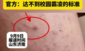 禽兽不如！山东一女生被同学锥子扎218针，官方：未达霸凌标准