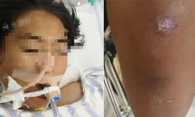 14岁女生被教官体罚致昏迷，家属：花费30万，还处于濒死状态