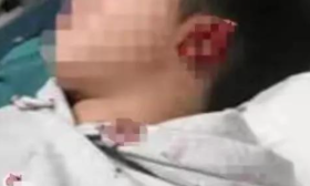 教师醉酒向他人饭菜吐口水、扇耳光、咬伤学生耳朵