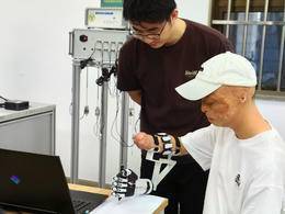 “烧伤男孩”东大报到，他说，“未来要造出自己的机械手！”